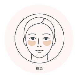 肝斑