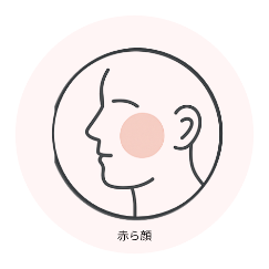 赤ら顔