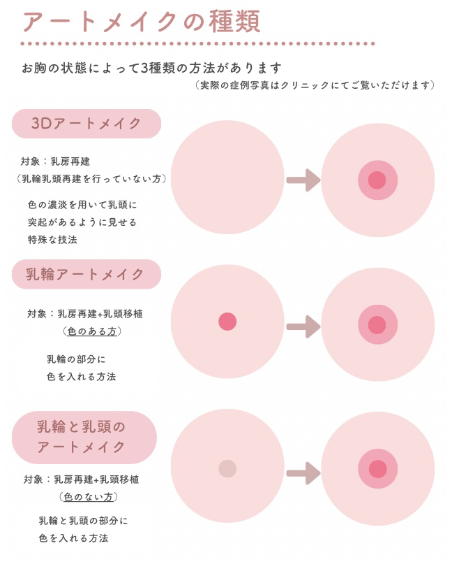 アートメイクの種類
